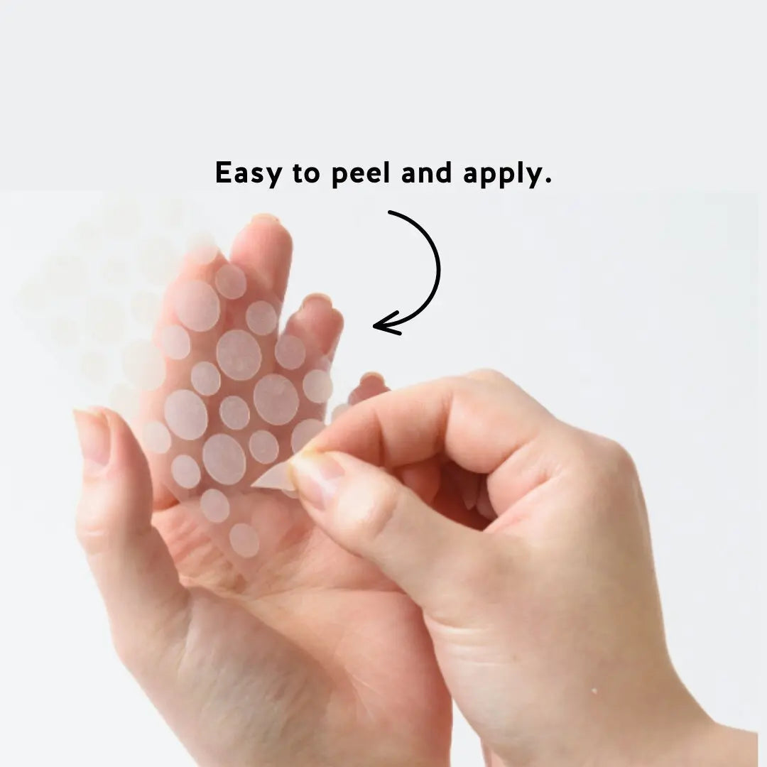 SMACNE Sticks and Acne Pimple Patches