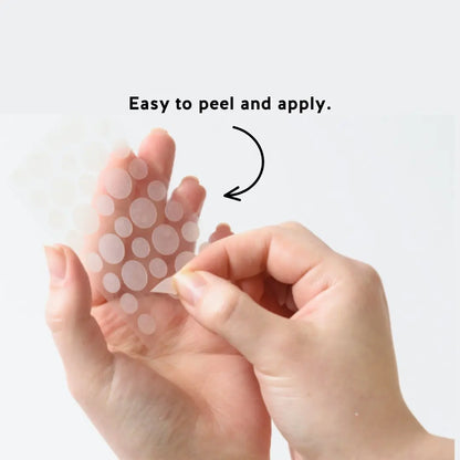 SMACNE Sticks and Acne Pimple Patches
