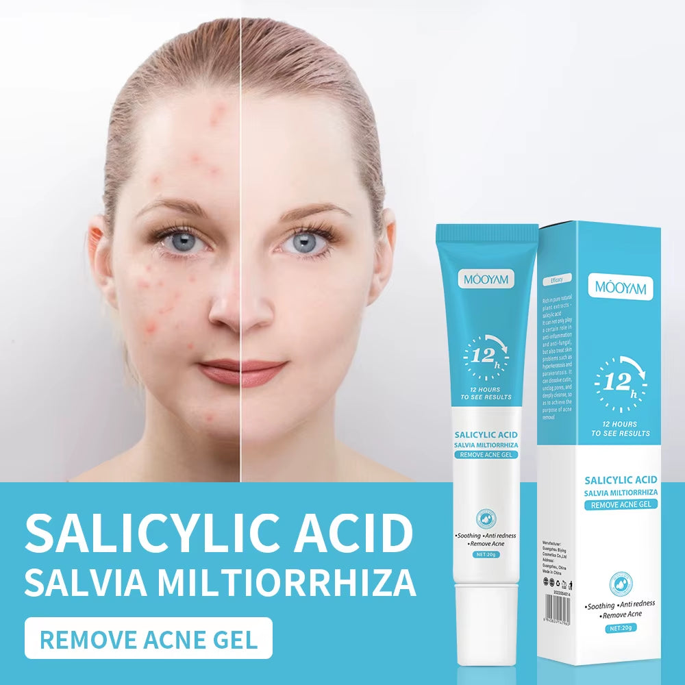 Salicylic Acid Acne Cream Reduces Acne Marks, Removes Acne, Closes Mouth and Shrinks Pores, Plant Essence Acne Gel