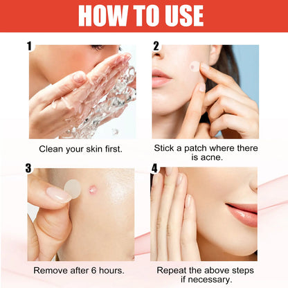 Pimple Patches for Face, Hydrocolloid Acne Patch Bulk, Acne Stickers for Covering Cheeks, Forehead, Chin Blemishes Zit Breakouts for All Skin Types