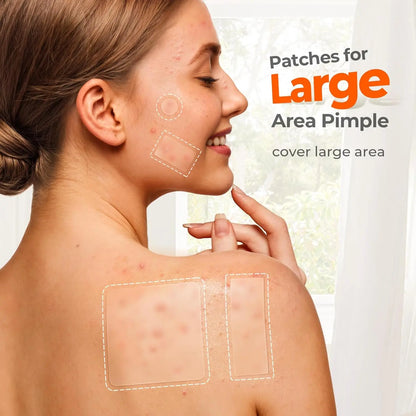 Large Pimple Patches for Face, 5Sizes XL Acne Patches, Big Hydrocolloid Bandages for Body, Chin, Forehead, Chest, Back Zit Breakouts, Hydrocolloid Patch (Strip, Square, Dot 443 Count)