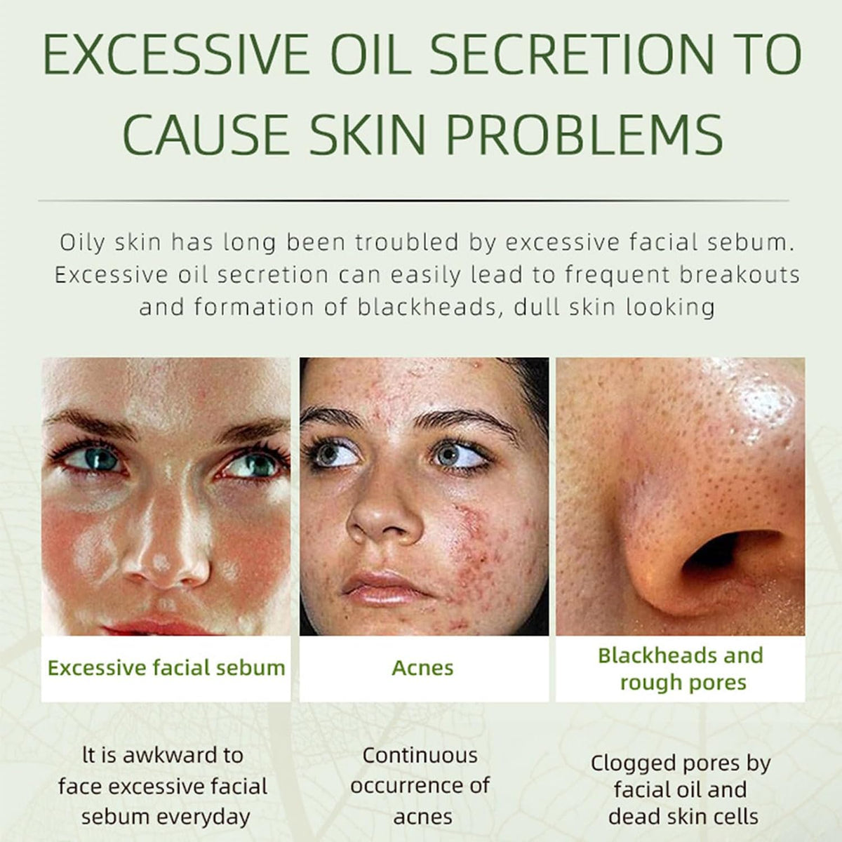 Acne Removing Face Cream,Natural Ingredients Professionally Remove Acne Marks,For Teens & Adults Anti-Acne Moisturizer Pimple Cream