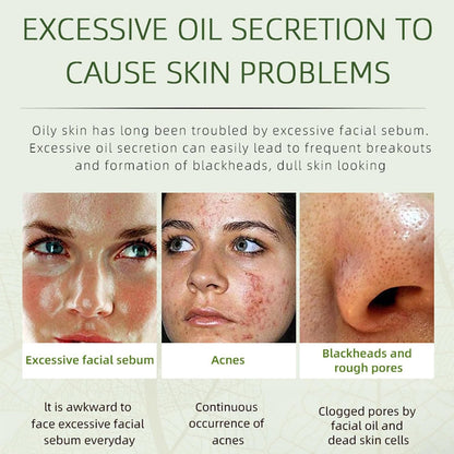 Acne Removing Face Cream,Natural Ingredients Professionally Remove Acne Marks,For Teens & Adults Anti-Acne Moisturizer Pimple Cream