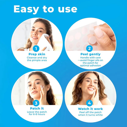 Patchrx Pimple Patches for Face, Hydrocolloid Acne Patches with Tea Tree Oil, Pimple Stickers - Acne Pimple Patches for Face - Zit Patches