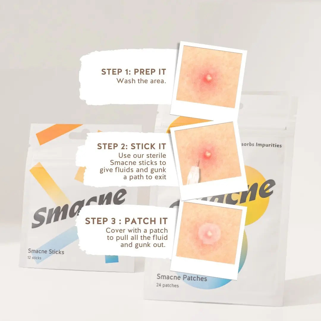 SMACNE Sticks and Acne Pimple Patches