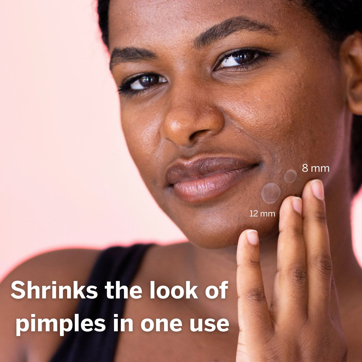 Dot Pimple & Zit Patches for Face – Hydrocolloid Acne Spot Patches with Vitamin C, Tea Tree Oil & Salicylic Acid for Blemish Care