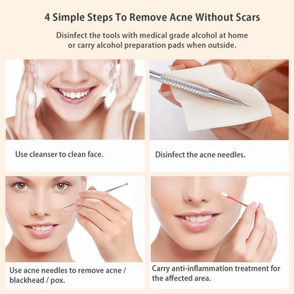 5 Acne Needles,Facial Acne Removal Extractor Blackhead Removal Kit,Blackhead Acne Remover Tool