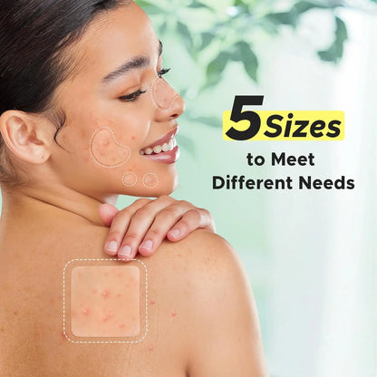 Litbear Pimple Patch, 507 Patches 5 Sizes Large Pimple Patches, Largepatch Hydrocolloid Bandages, Zit Stickers for Forehead, Body, Nose, Back, and Chest Zitsticker Pack