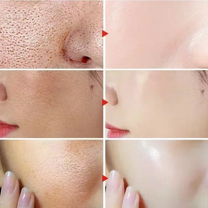 Skintifik Clarifying BHA Exfoliant — before and after skin texture