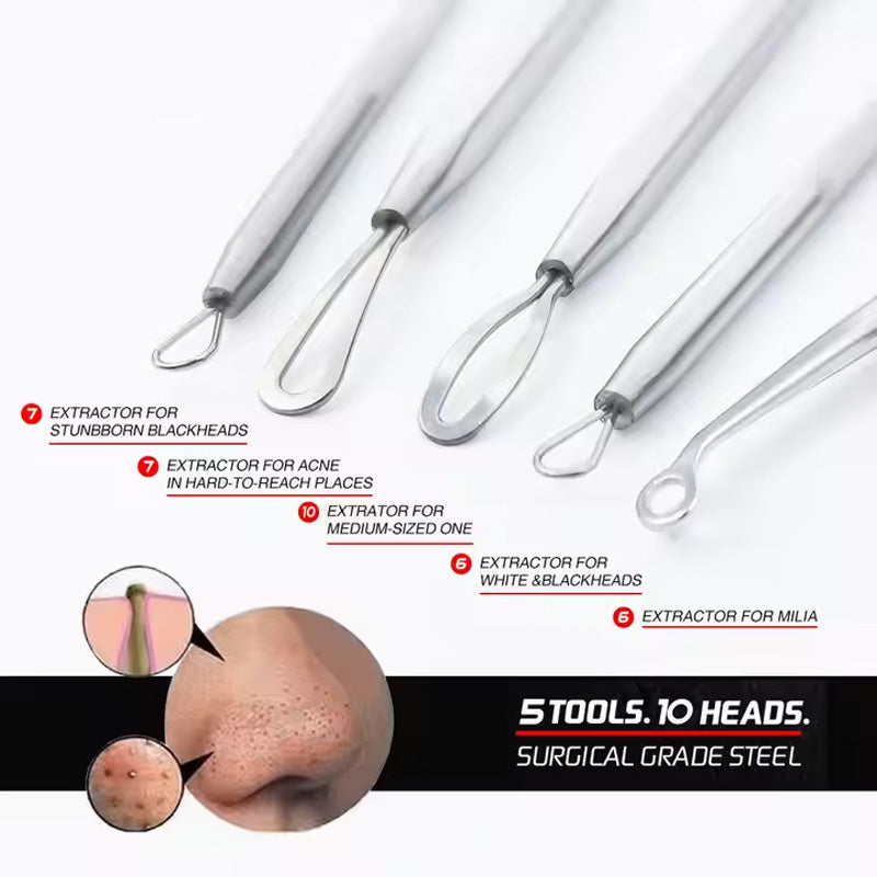 5 Acne Needles,Facial Acne Removal Extractor Blackhead Removal Kit,Blackhead Acne Remover Tool