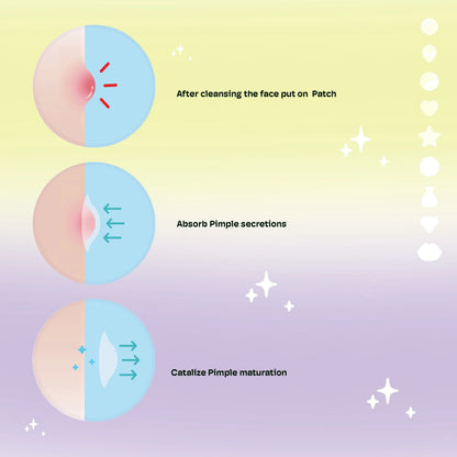 Wawie Fun Pimple Patches