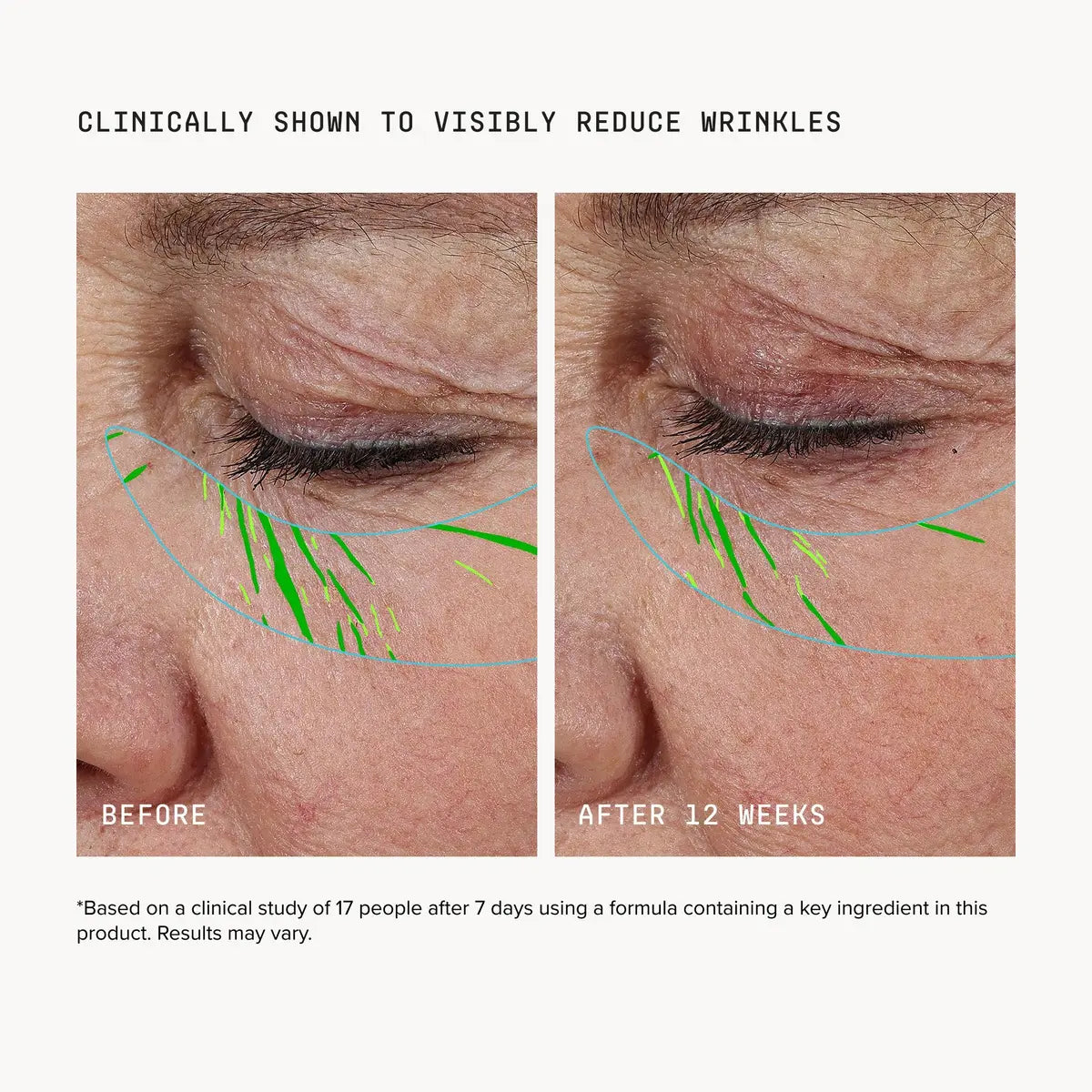 DRMTLGY Needle-Less Growth Factor Firming and Lifting Serum