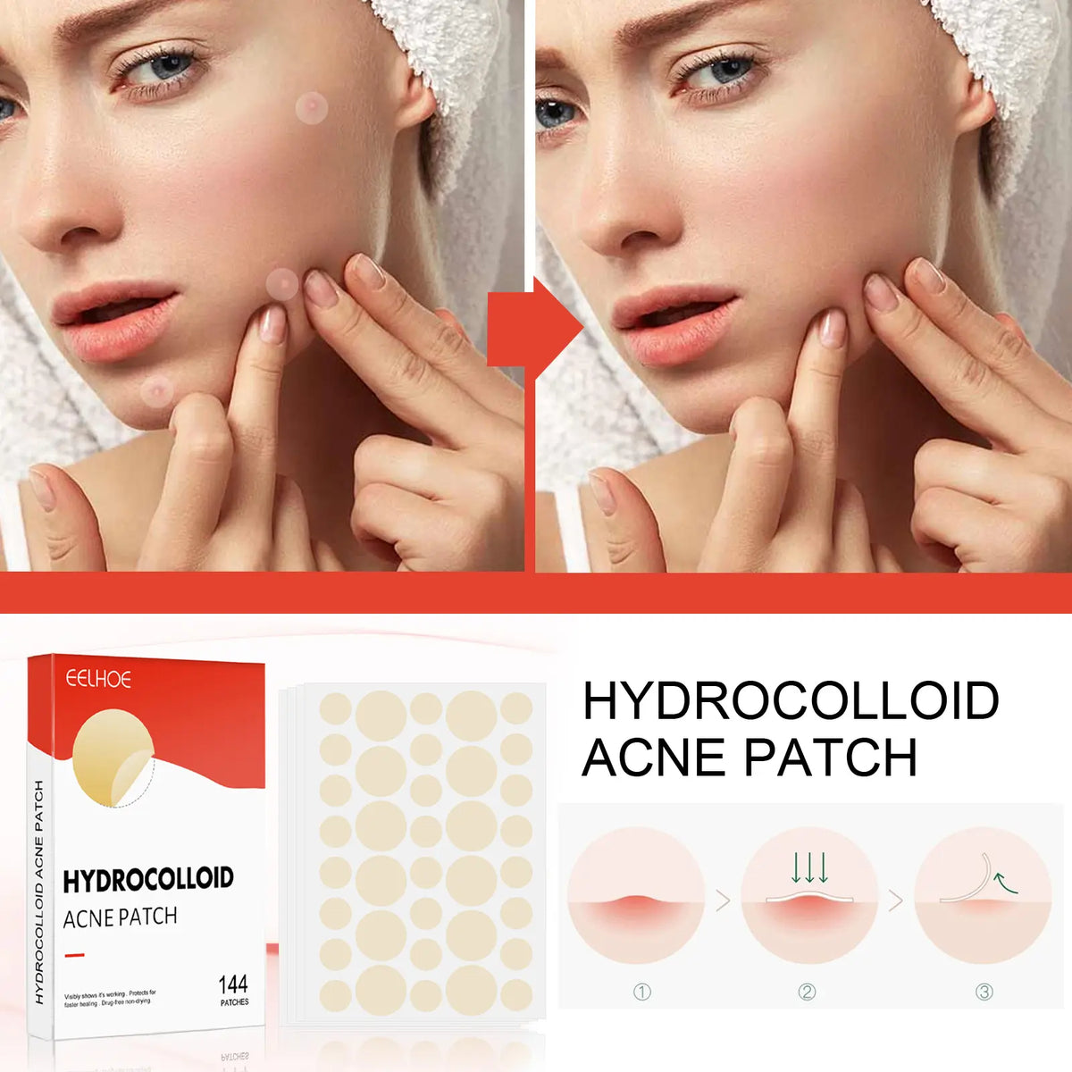 Pimple Patches for Face, Hydrocolloid Acne Patch Bulk, Acne Stickers for Covering Cheeks, Forehead, Chin Blemishes Zit Breakouts for All Skin Types