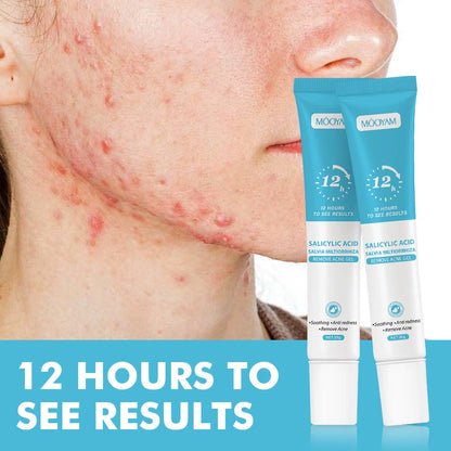 Salicylic Acid Acne Cream Reduces Acne Marks, Removes Acne, Closes Mouth and Shrinks Pores, Plant Essence Acne Gel